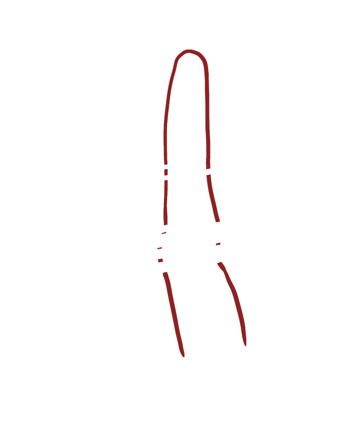 分绞